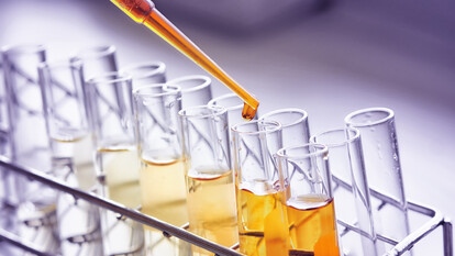L'immagine mostra un laboratorio dove una pipetta rilascia un liquido in provette. Sono visibili anche bicchieri di vetro contenenti liquidi. L'ambiente &egrave; caratterizzato da attrezzature da laboratorio e materiali trasparenti. Secondo l'ECDC, non ci sono mutazioni nell'hantavirus e si prevede la necessit&agrave; di quattro nuovi laboratori per malattie infettive nell'Unione Europea.